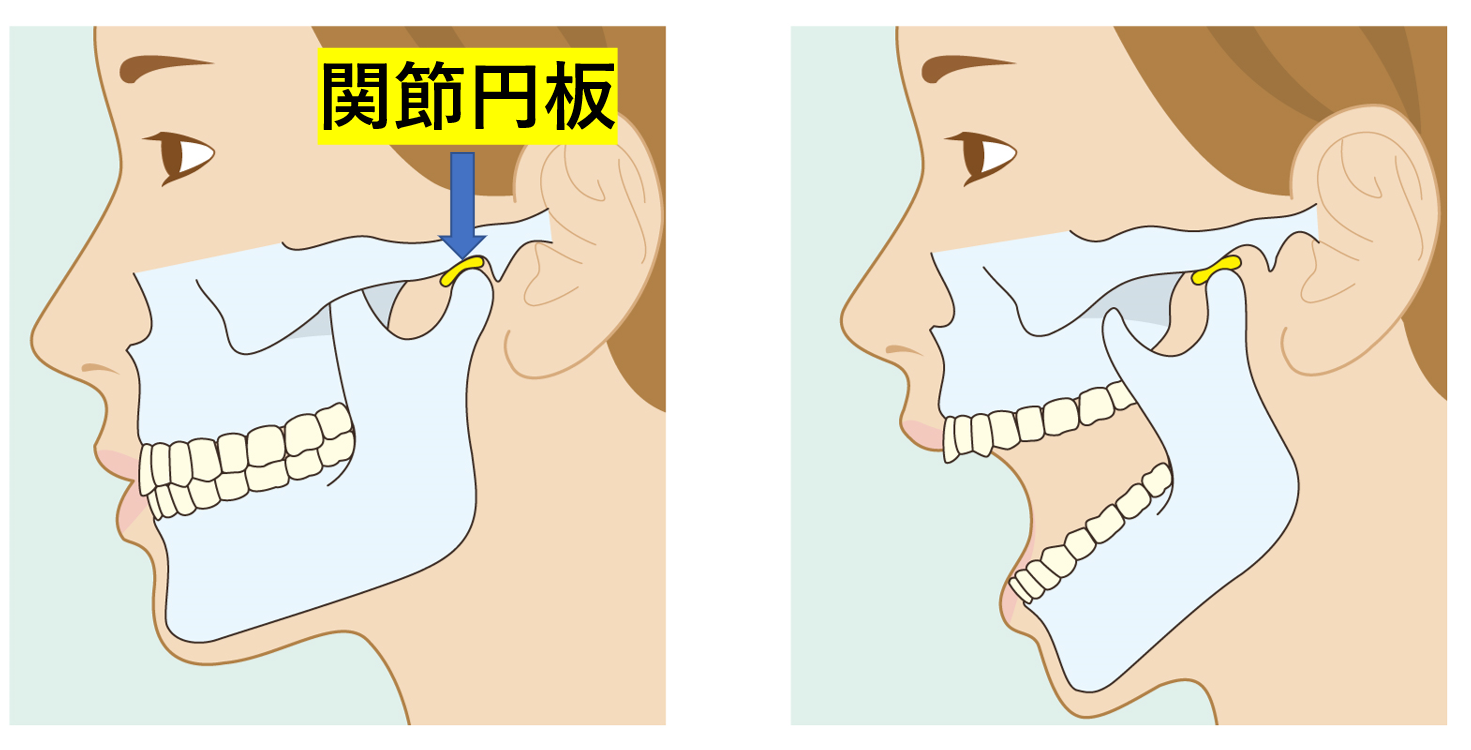 顎 つる よう な 痛み